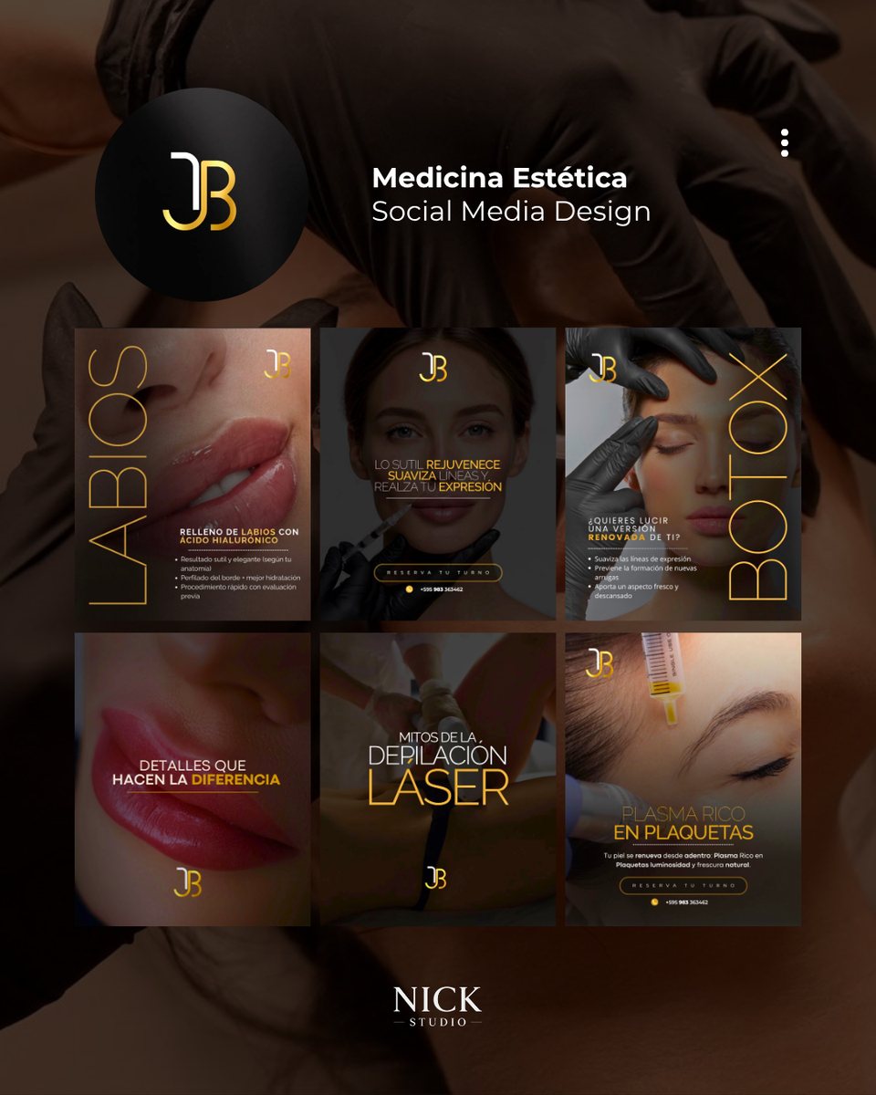 Flyers de JB, medicina estética: labios, botox, depilación láser y plasma rico en plaquetas, en negro y dorado